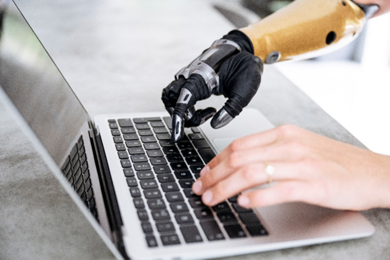 a person's hands - one is a bionic arm - using a laptop