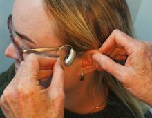 hands putting on hearing aid on a woman